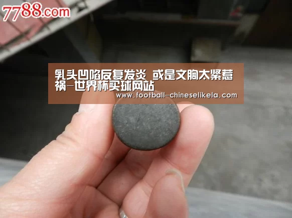 乳头凹陷反复发炎 或是文胸太紧惹祸-世界杯买球网站(图1) 世界杯买球平台