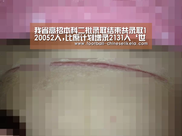 世界杯买球